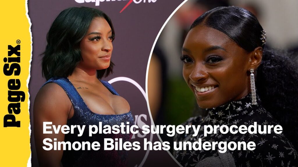 Here is every plastic surgery procedure Simone Biles has had done Here is every plastic surgery procedure Simone Biles has had done