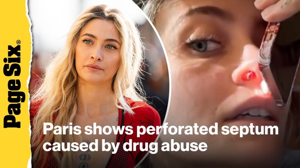 Paris Jackson reveals perforated septum due to drug use Paris Jackson reveals perforated septum due to drug use