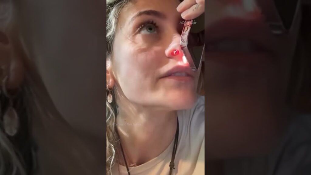 Paris Jackson Reveals She Has A ‘Perforated Septum’ As She Says Drugs ‘Ruined’ Her Life
