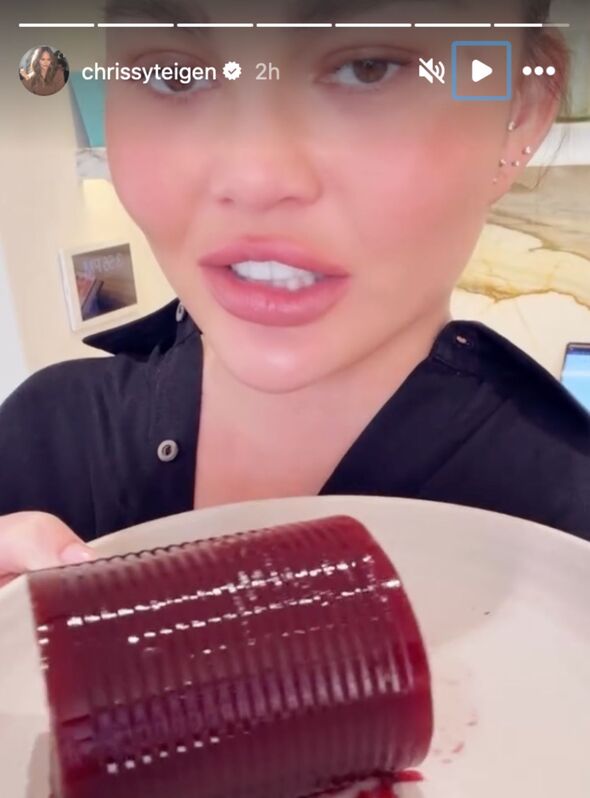 Chrissy Teigen