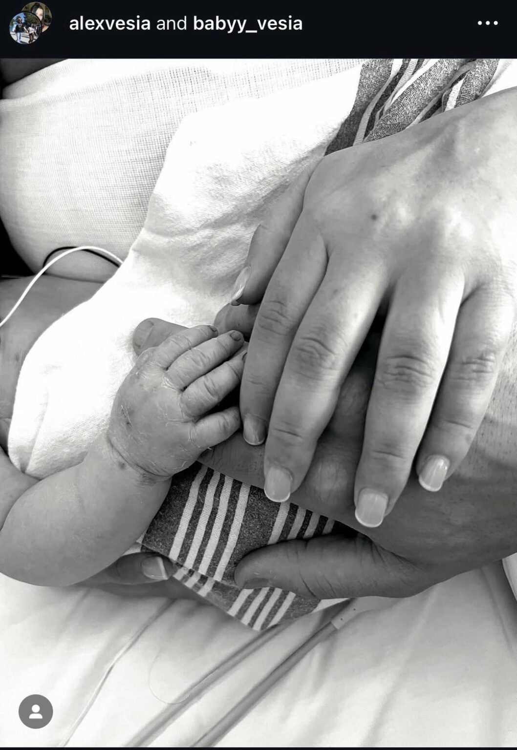 Dodgers Pitcher Alex Vesia and Wife Kayla Announce Stillbirth of Their First Baby Together "There are no words to describe the pain we’re going through but we hold her in our hearts and cherish every second we had with her”