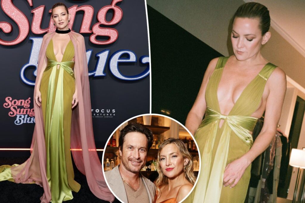 Oliver Hudson pokes fun at sister Kate Hudson’s plunging red carpet Valentino dress Oliver Hudson pokes fun at sister Kate Hudson’s plunging red carpet Valentino dress