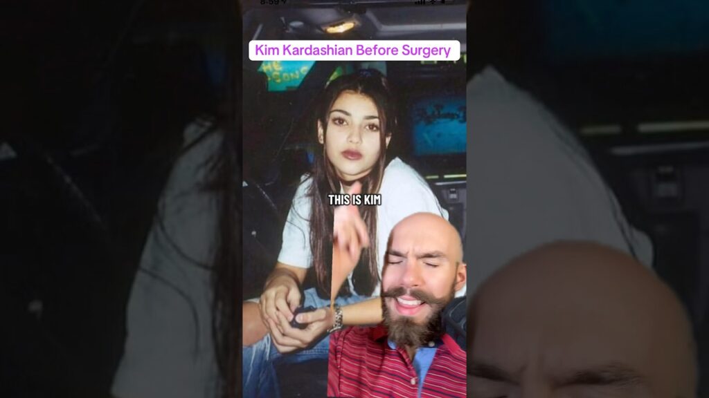 Kim Kardashian Before Surgery #kimkardashian #plasticsurgery