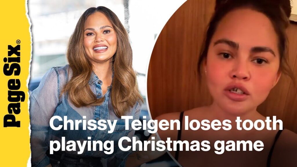 Chrissy Teigen's tooth falls out in Christmas game 'gone wrong'