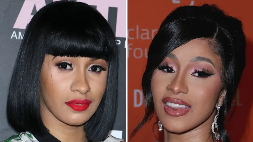 Side-by-side photos of Cardi B from earlier in her career and a later public appearance showing changes following cosmetic surgery