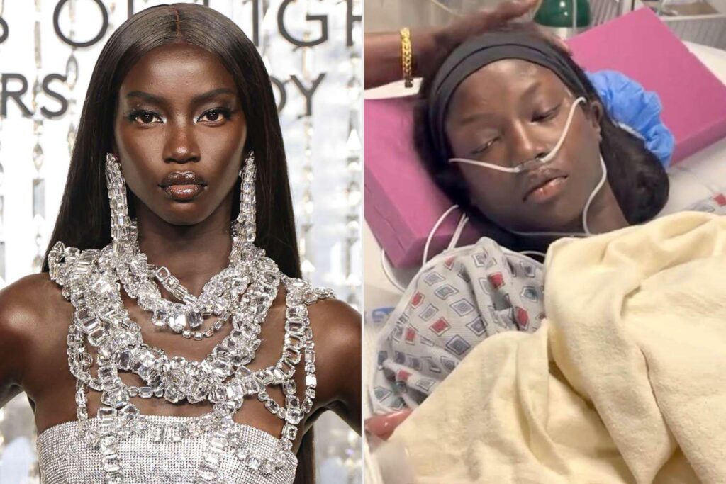 Supermodel Anok Yai, 28, Diagnosed with 'Congenital Defect' That Was 'Destroying' Her Lungs and Left Her 'Struggling to Breathe'