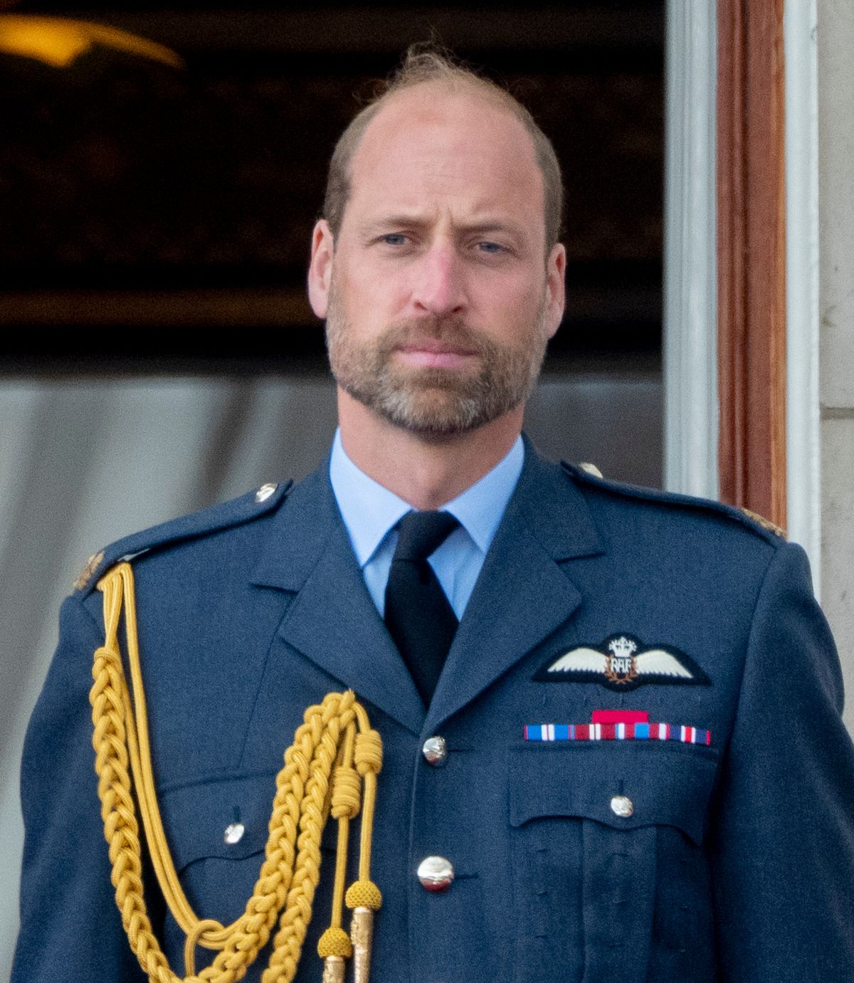 The expert believes William has bigger issues to deal with