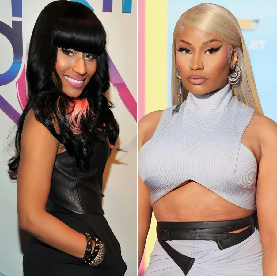 Side-by-side photos of Nicki Minaj from earlier in her career and a later public appearance showing changes following cosmetic procedures
