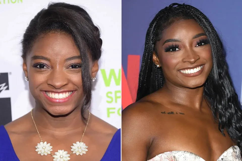 Side-by-side photos of Simone Biles in 2014 and 2025 showing changes after her lower blepharoplasty and earlobe surgery