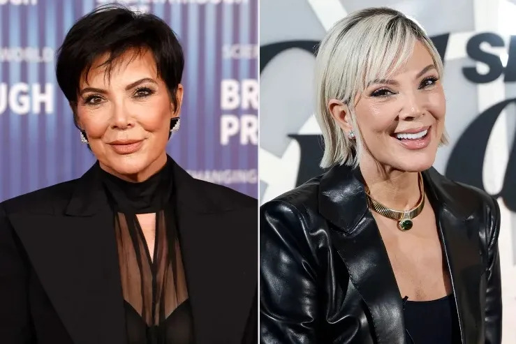 Side-by-side photos of Kris Jenner at public events before and after undergoing facelift surgery
