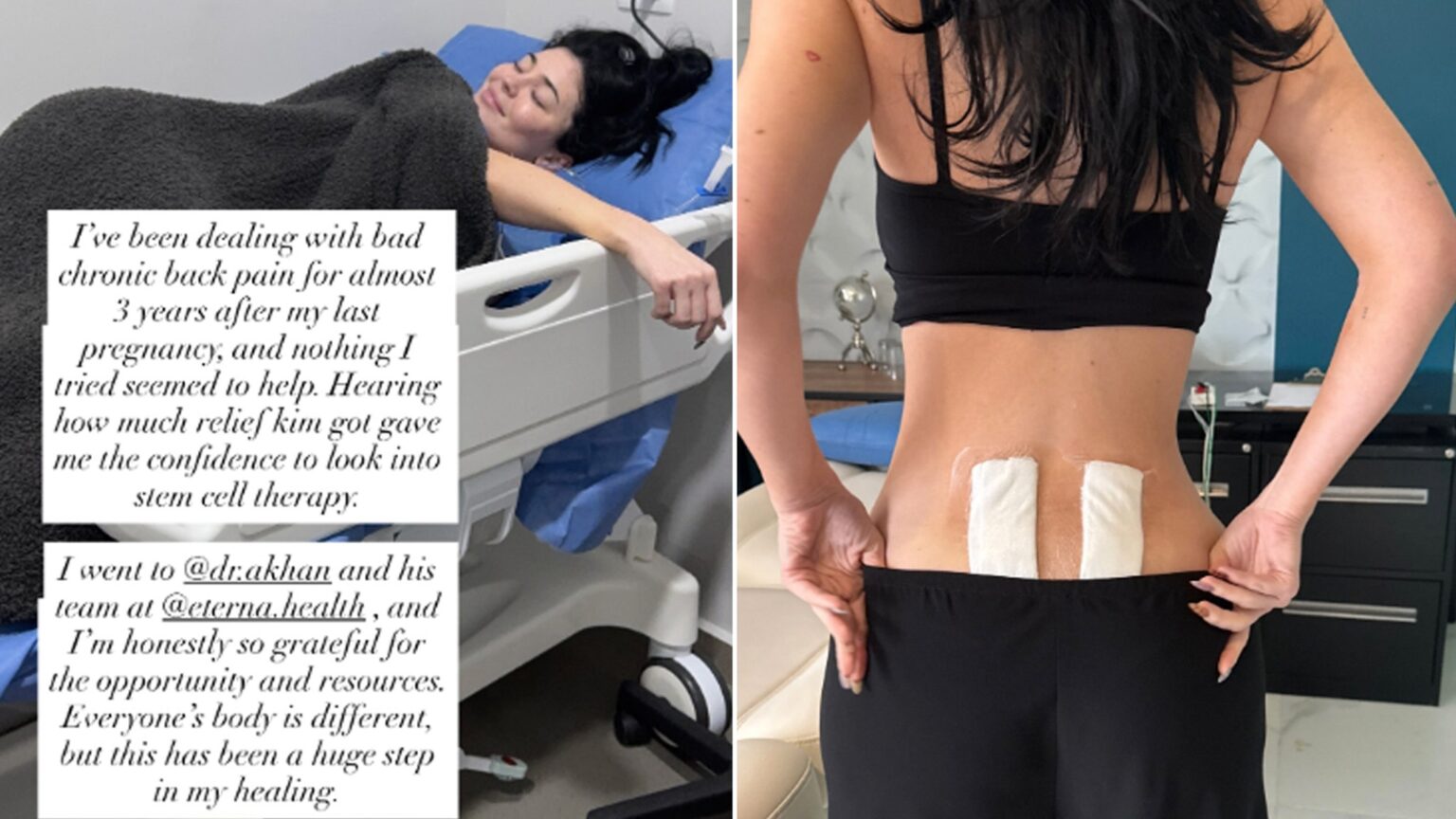 Why Kylie Jenner Underwent Stem Cell Therapy