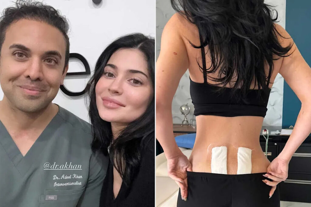 Kylie Jenner Reveals She Underwent Stem Cell Therapy to Get 'Relief' from Chronic Back Pain Following Pregnancy