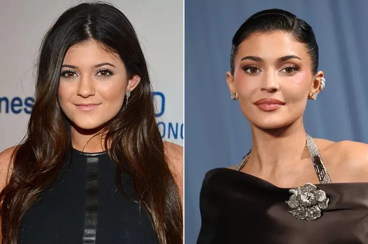 Side-by-side photos of Kylie Jenner in 2012 and at the 2025 Met Gala showing changes after cosmetic enhancements