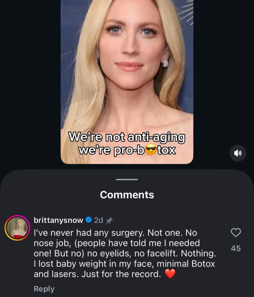 Britanny Snow talks about what procedures she's done (or not done). Says she's done nothing but (minimal) botox and laser.
