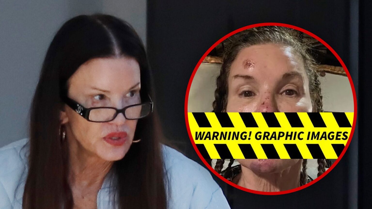 Janice Dickinson Spotted After Sharing Alleged Injuries From Reality Show Fall