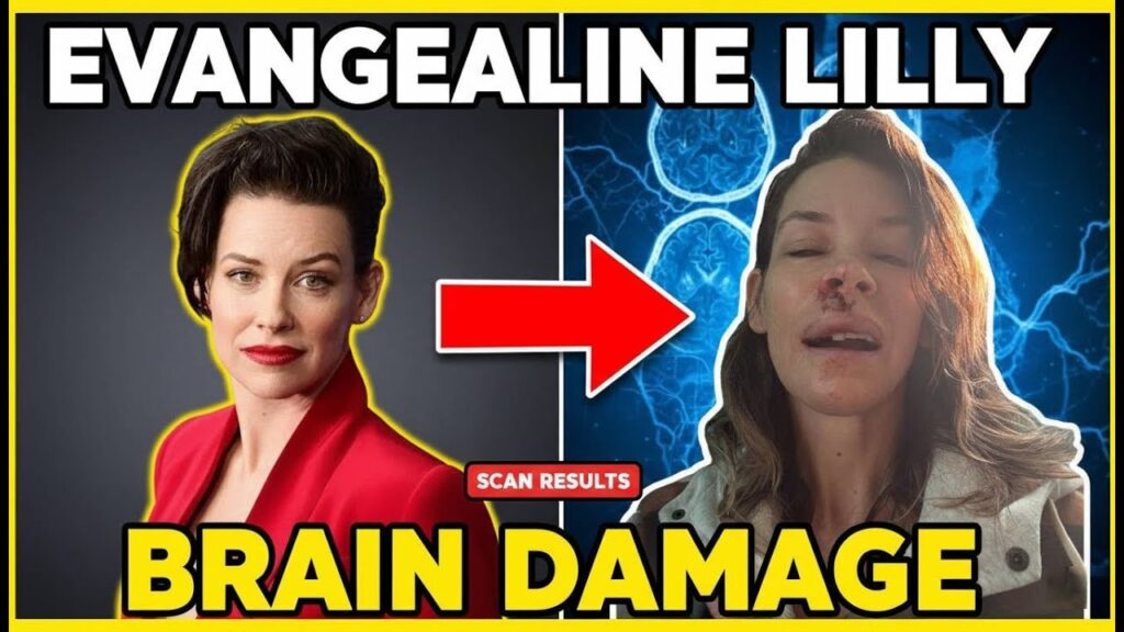 Evangeline Lilly Brain Damage After Shocking Hawaii Fall