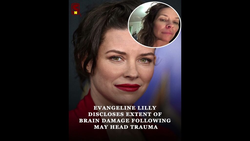 Evangeline Lilly Reveals ‘Extensive’ Brain Damage Following 2025 Head Injury Evangeline Lilly Reveals ‘Extensive’ Brain Damage Following 2025 Head Injury