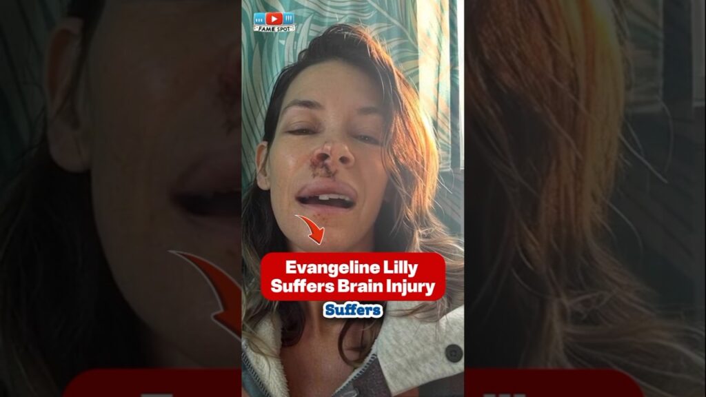 Evangeline Lilly Suffers Brain Injury After Boulder Accident #shorts