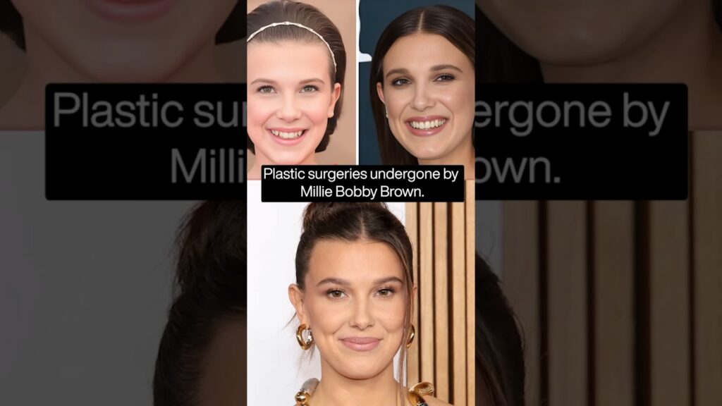 Millie Bobby Brown Before & After | Natural Glow-Up or Aesthetic Enhancements?