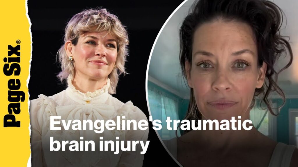 Evangeline Lilly shares treatment plan after traumatic brain injury