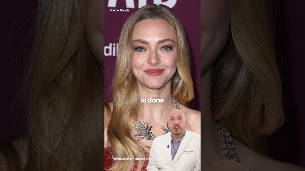 Amanda Seyfried Before & After Plastic Surgery 🥰