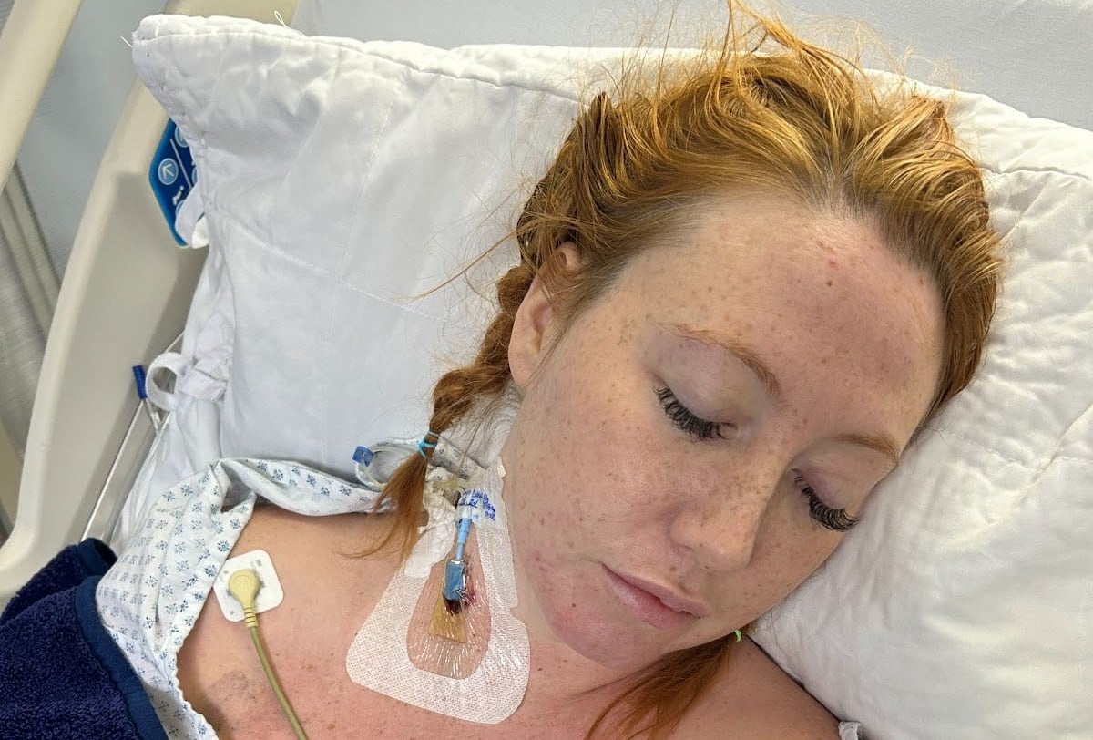 A woman lays in a hospital bed, eyes closed with monitoring equipment connected to her chest.