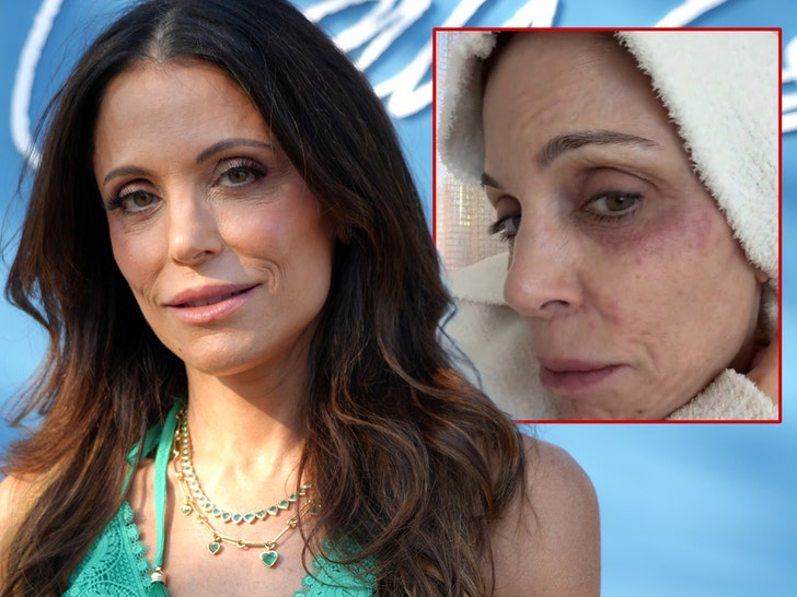 betheny frankel rash getty comp