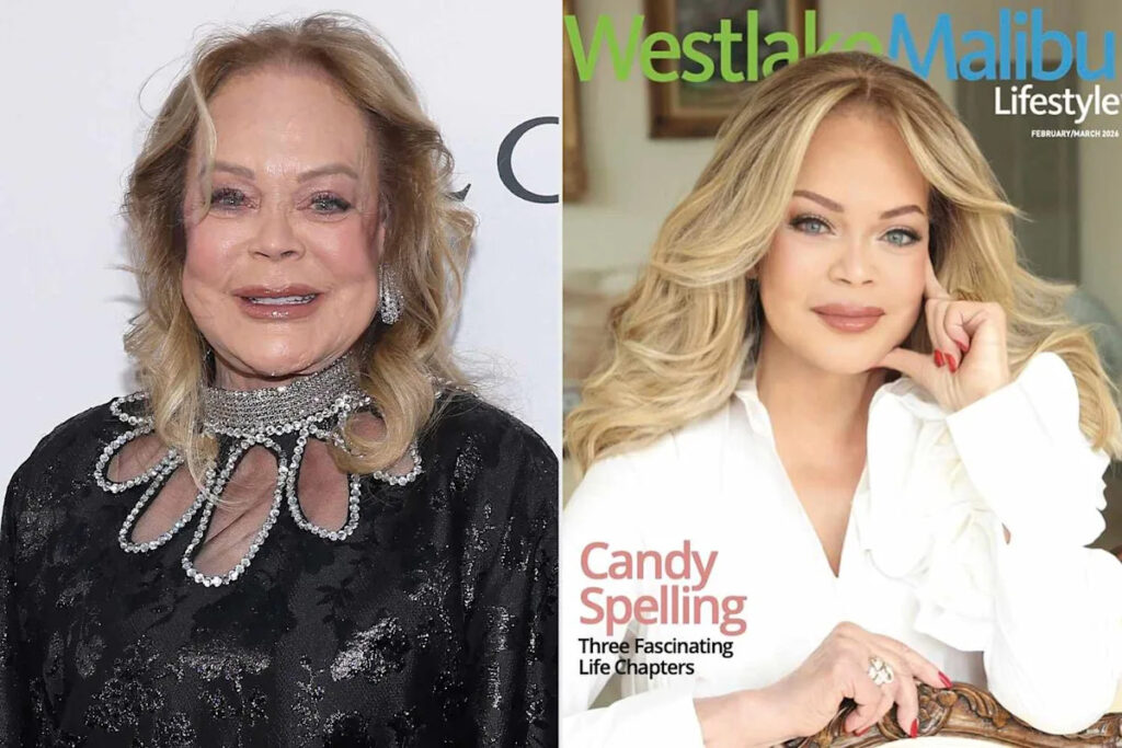 Tori Spelling's Mom, Candy, 80, Turns Heads with Striking New Magazine Cover