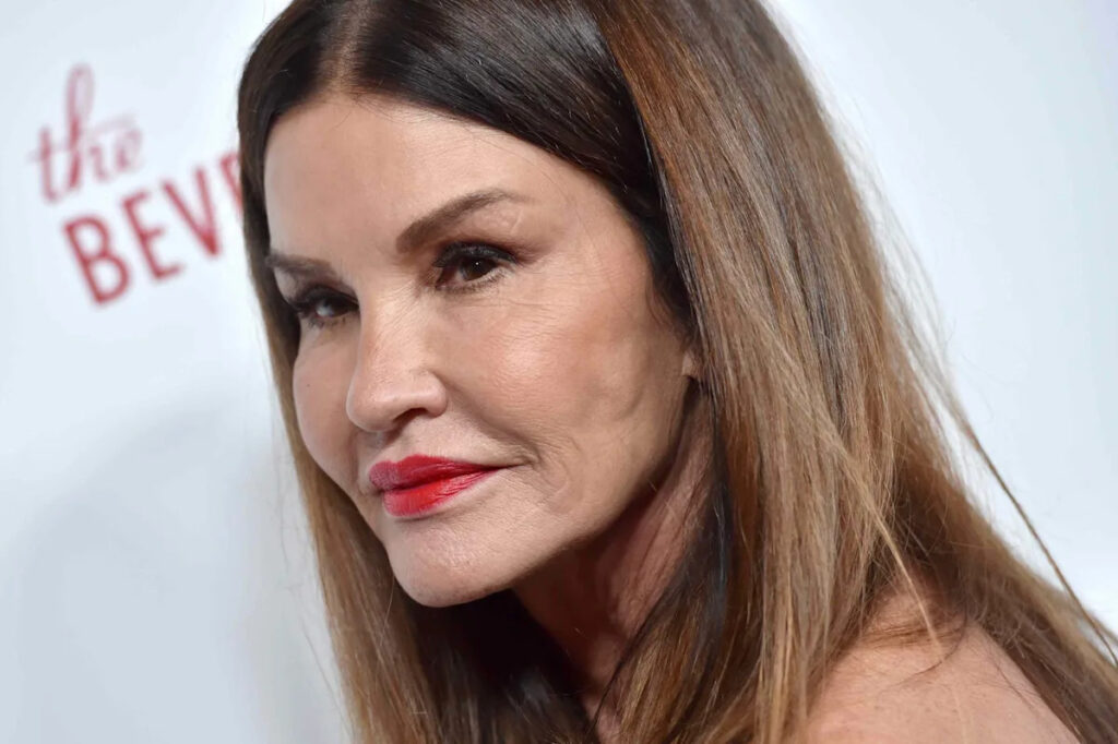 Janice Dickinson Reveals Severe Injuries That Reportedly Left Her Face "Permanently Altered"