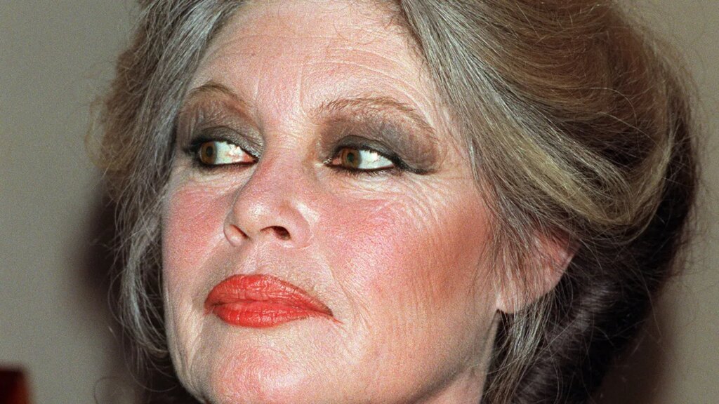Brigitte Bardot cause of death revealed