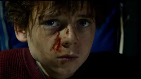 Sony Pictures Alfie Williams is dressed as his character Spike from 28 Years Later: The Bone Temple. He looks directly into camera, and appears to be injured with blood on his face. 