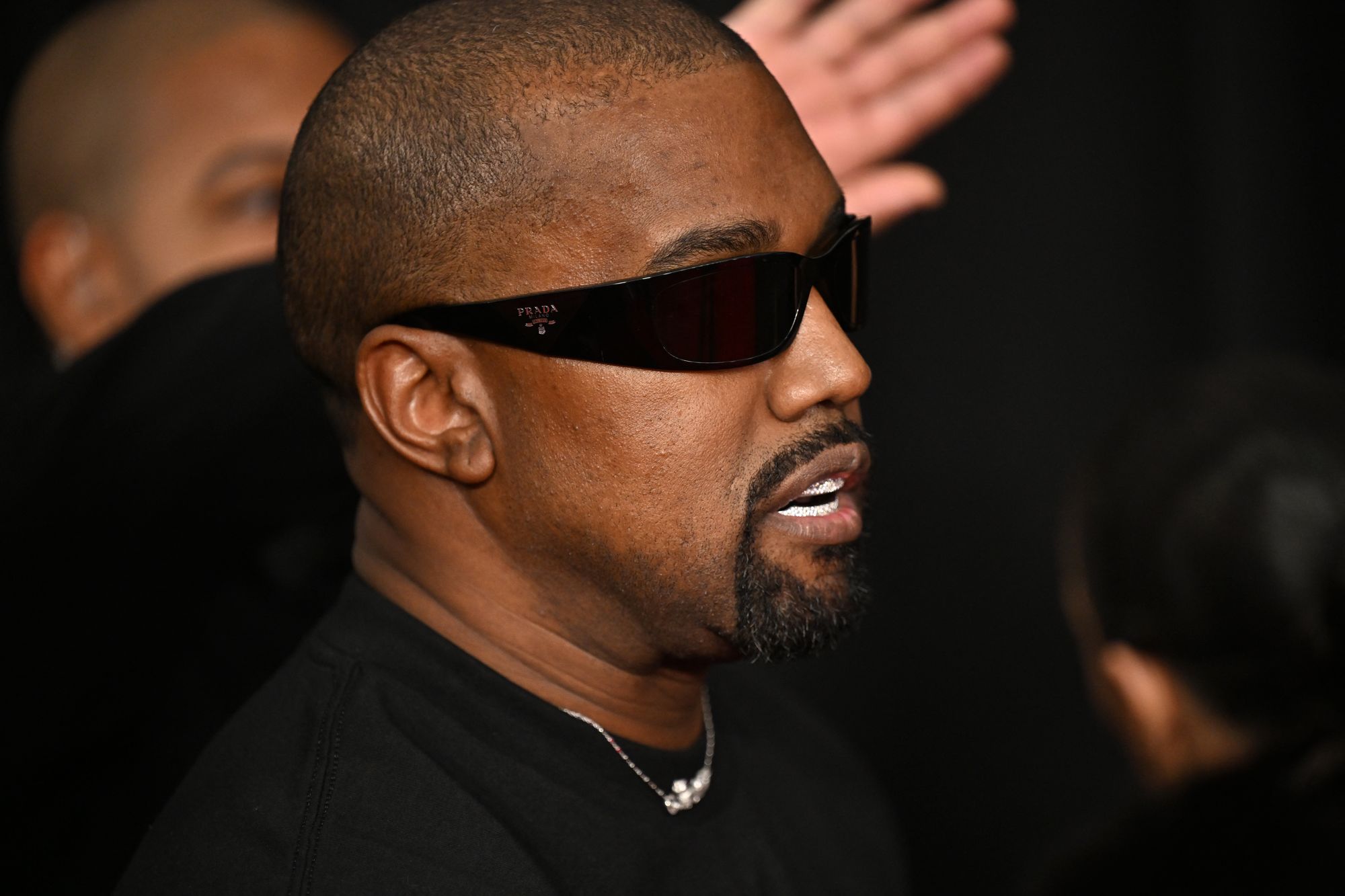Kanye West has blamed his offensive behavior in recent years on a brain injury