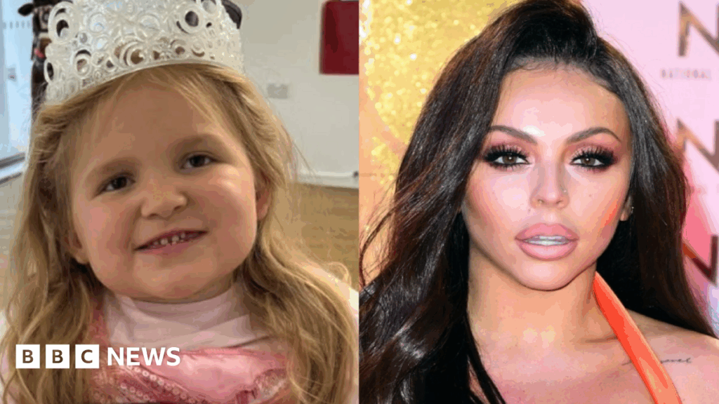 Our children waited too long for same diagnosis as Jesy Nelson’s twins Jesy Nelson is wearing a black top, has long reddish brown hair and is looking at the camera with lip fillers. Behind her is a brightly purple room.