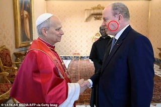 Monaco’s Prince Albert seen with scar on cheek as he meets Pope after undergoing procedure for ‘benign dermatological condition’