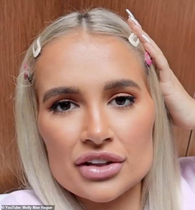 Molly-Mae Hague previously said she looks five years younger after getting her fillers dissolved (pictured with filler in 2019)