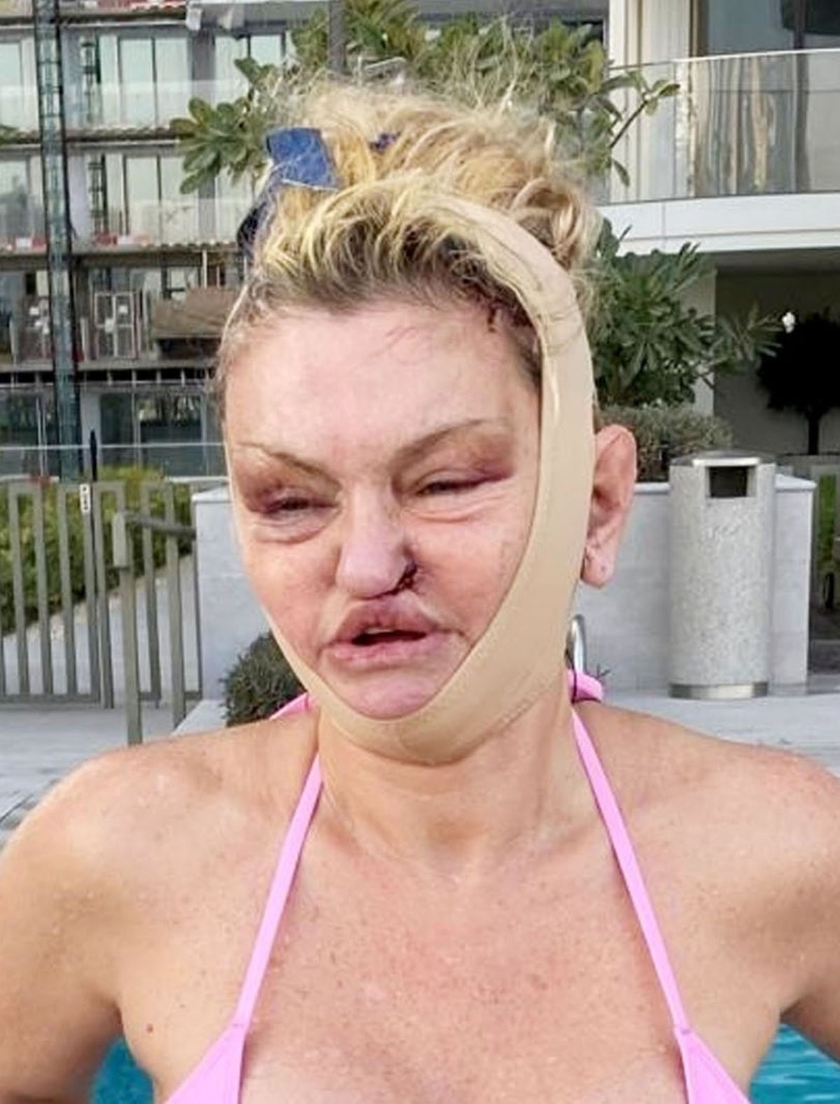 Her face looked bandaged and bruised