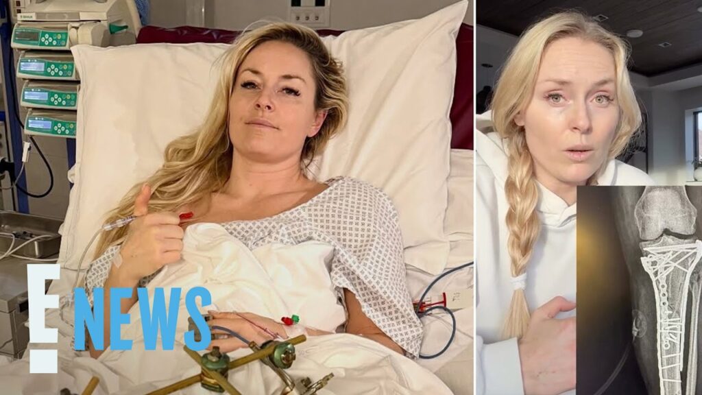 Lindsey Vonn Nearly Lost Her Leg After Olympics Crash | E! News