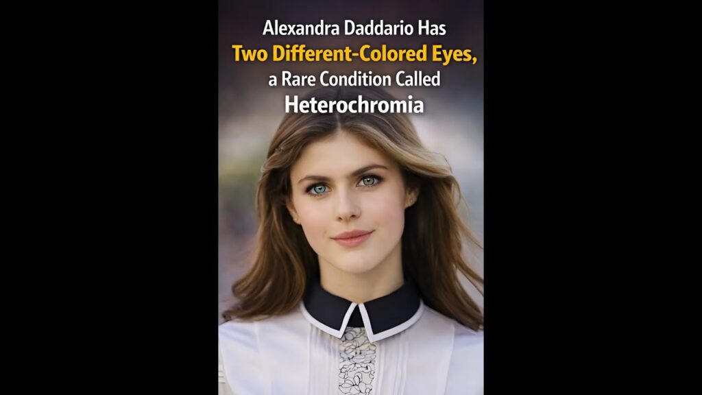Alexandra Daddario’s Rare Two-Colored Eyes Explained