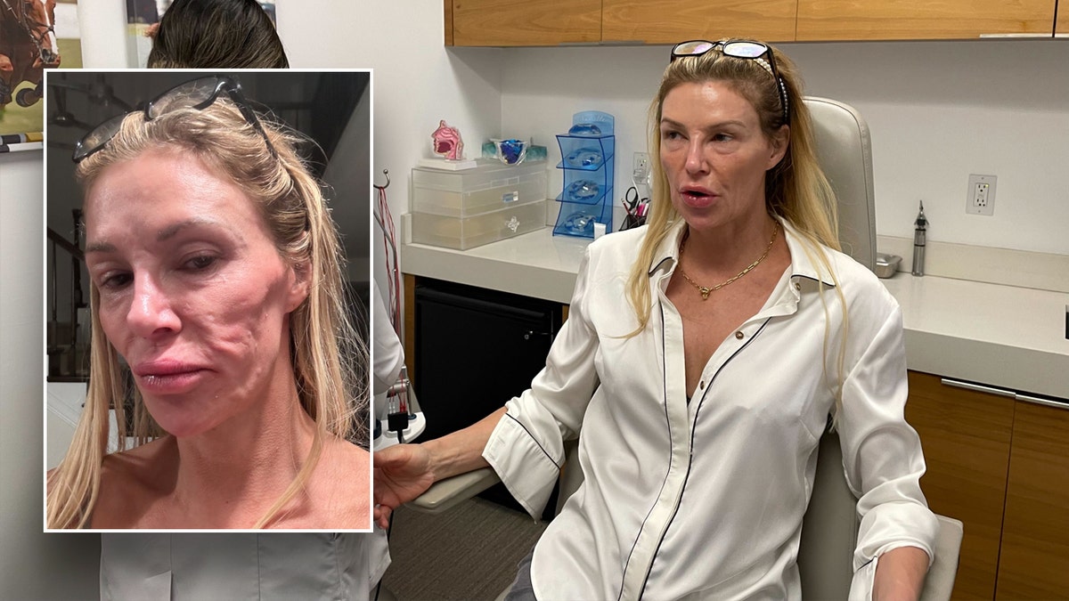Brandi Glanville's face after illness