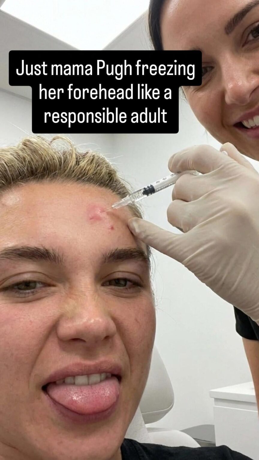 Some pics of Florence Pugh getting botox and fillers