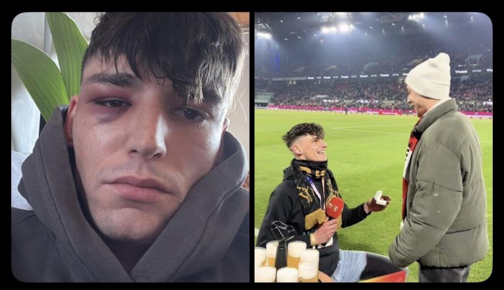 German soccer referee Pascal Kaiser was assaulted by three men at his home, a week after his public marriage proposal. The day before the assault, he received threats, and his address was leaked. He contacted the police, who told him there was no immediate danger.
