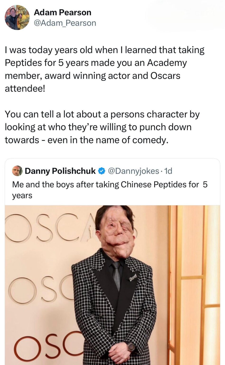 Adam Pearson responds to comedian’s tweet: “You can tell a lot about a persons character by looking at who they're willing to punch down towards - even in the name of comedy.”