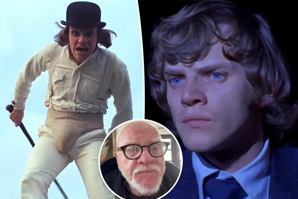 Malcolm McDowell struggled with his sudden rise to fame Malcolm McDowell struggled with his sudden rise to fame