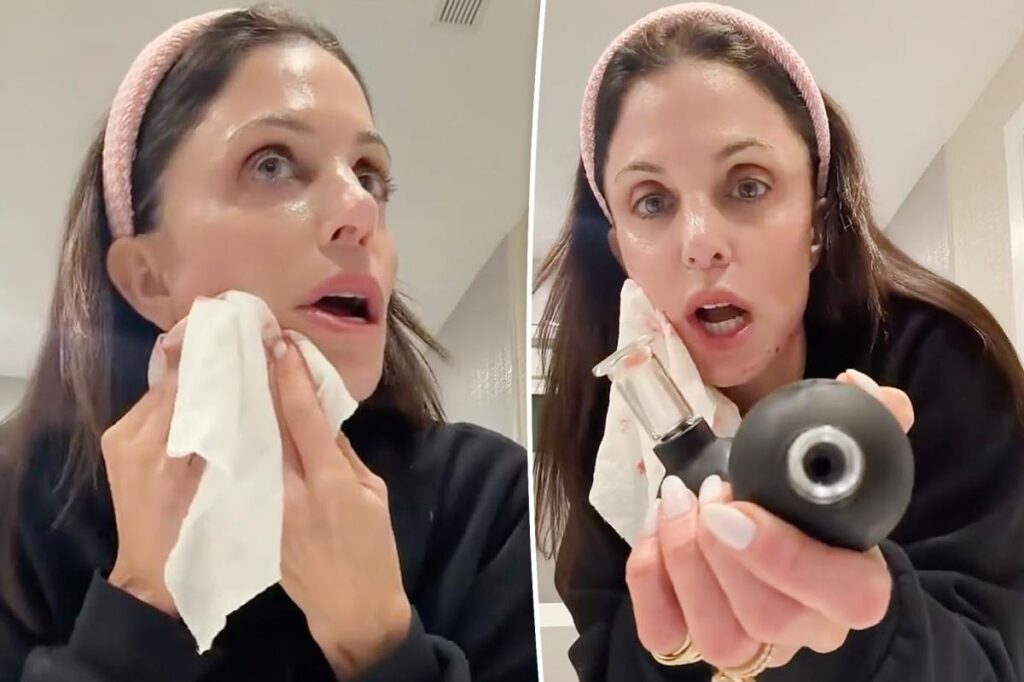 Bethenny Frankel slices her face open with beauty tool in bloody video