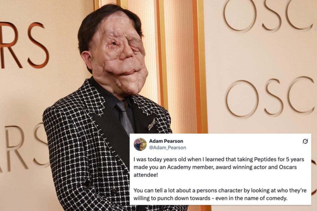 Actor Adam Pearson and fans clap back at comedian’s 'hateful' tweet about him