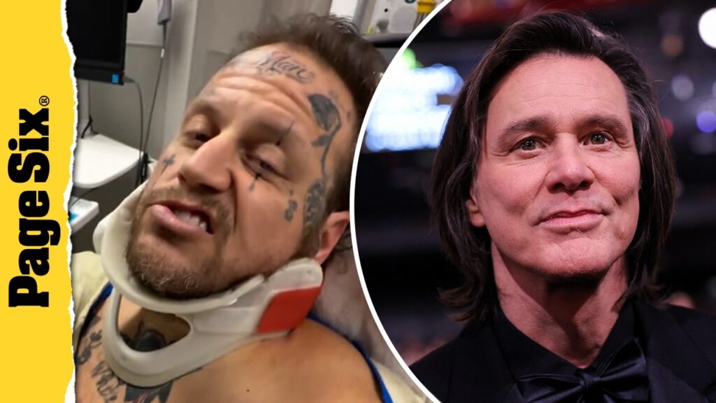 Jelly Roll hospitalized from ATV crash, Jim Carrey addresses 'unrecognizable' appearance | Headlines