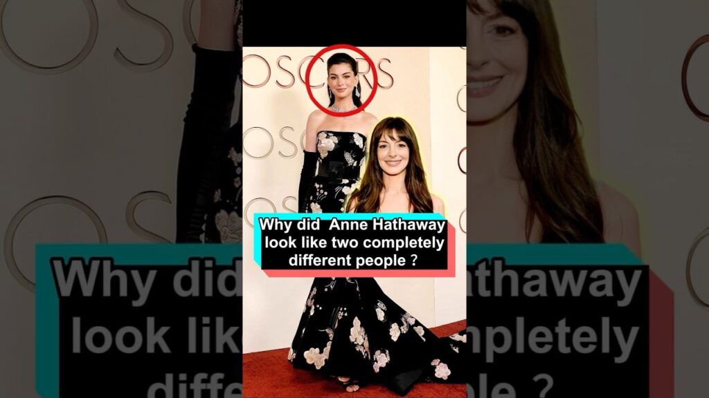Why did 43-year-old Anne Hathaway look like two completely different people after her appearance at