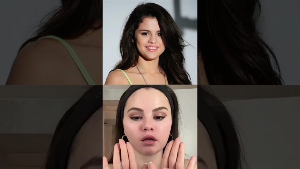 What Happened to Selena Gomez’s Appearance?