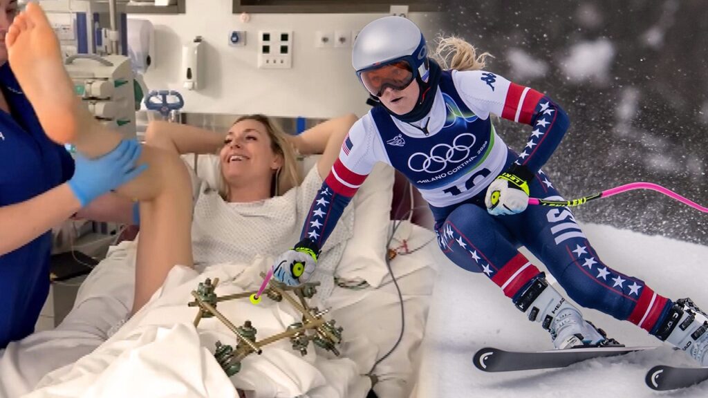 Lindsey Vonn Won't Say She's Done Skiing After Life-Changing Olympics Injury
