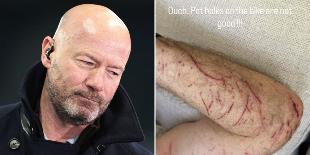 BBC pundit Alan Shearer suffers gruesome injuries after bike hits pothole in major crash BBC pundit Alan Shearer suffers gruesome injuries after bike hits pothole in major crash